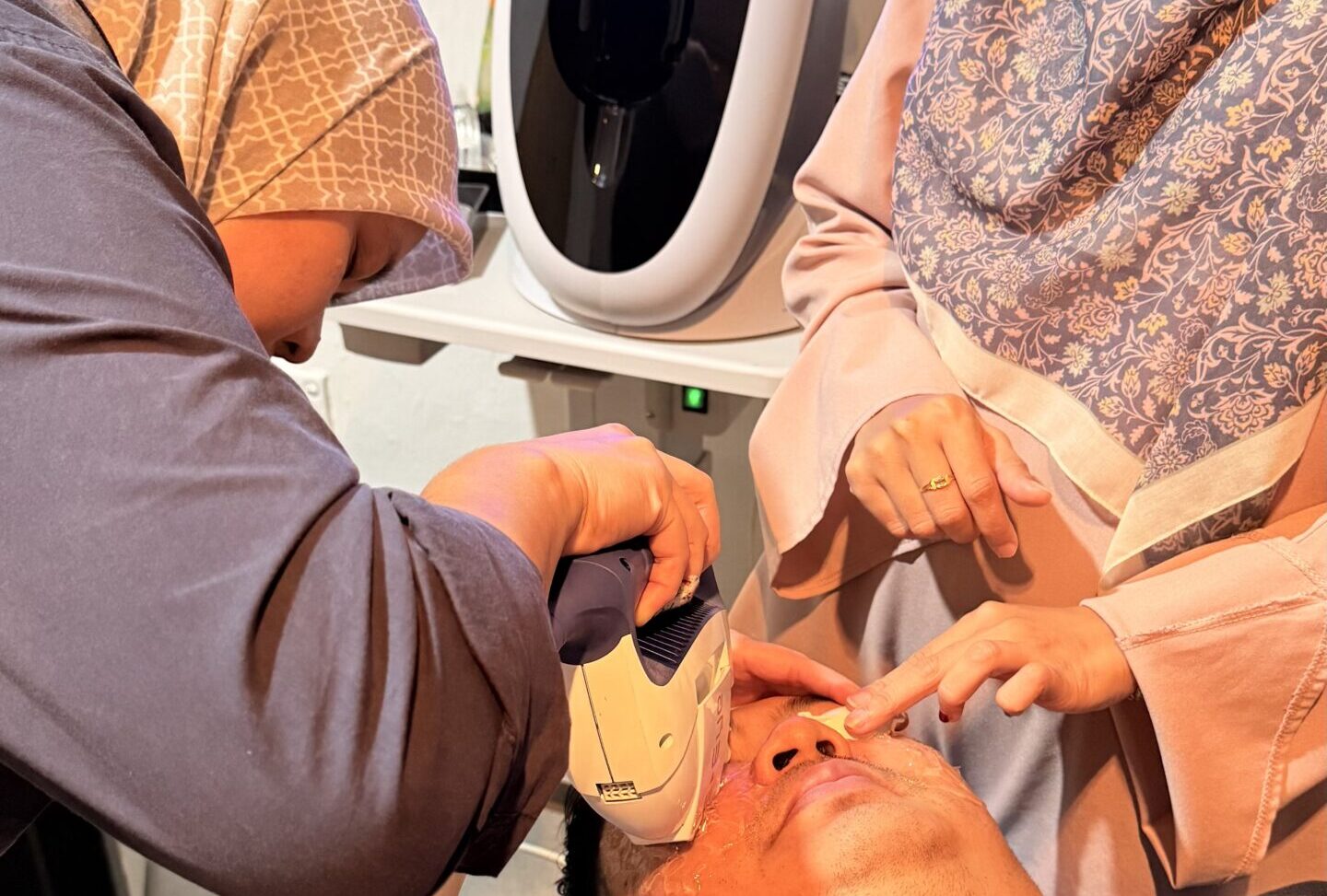 Dry Eye - EIPL Treatment 2