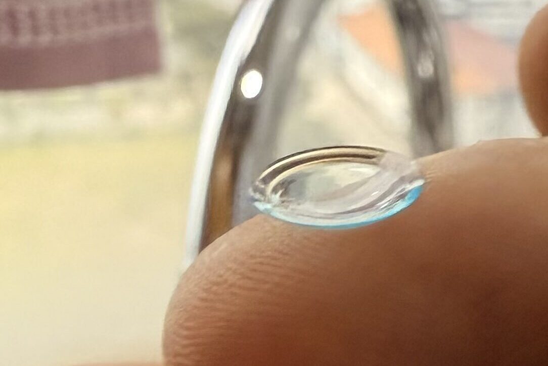 OrthoK Lens Fitting(1)